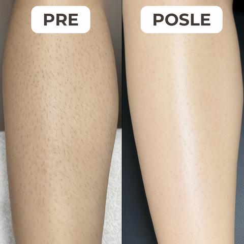 VGR V-706 Professional Lady Epilator